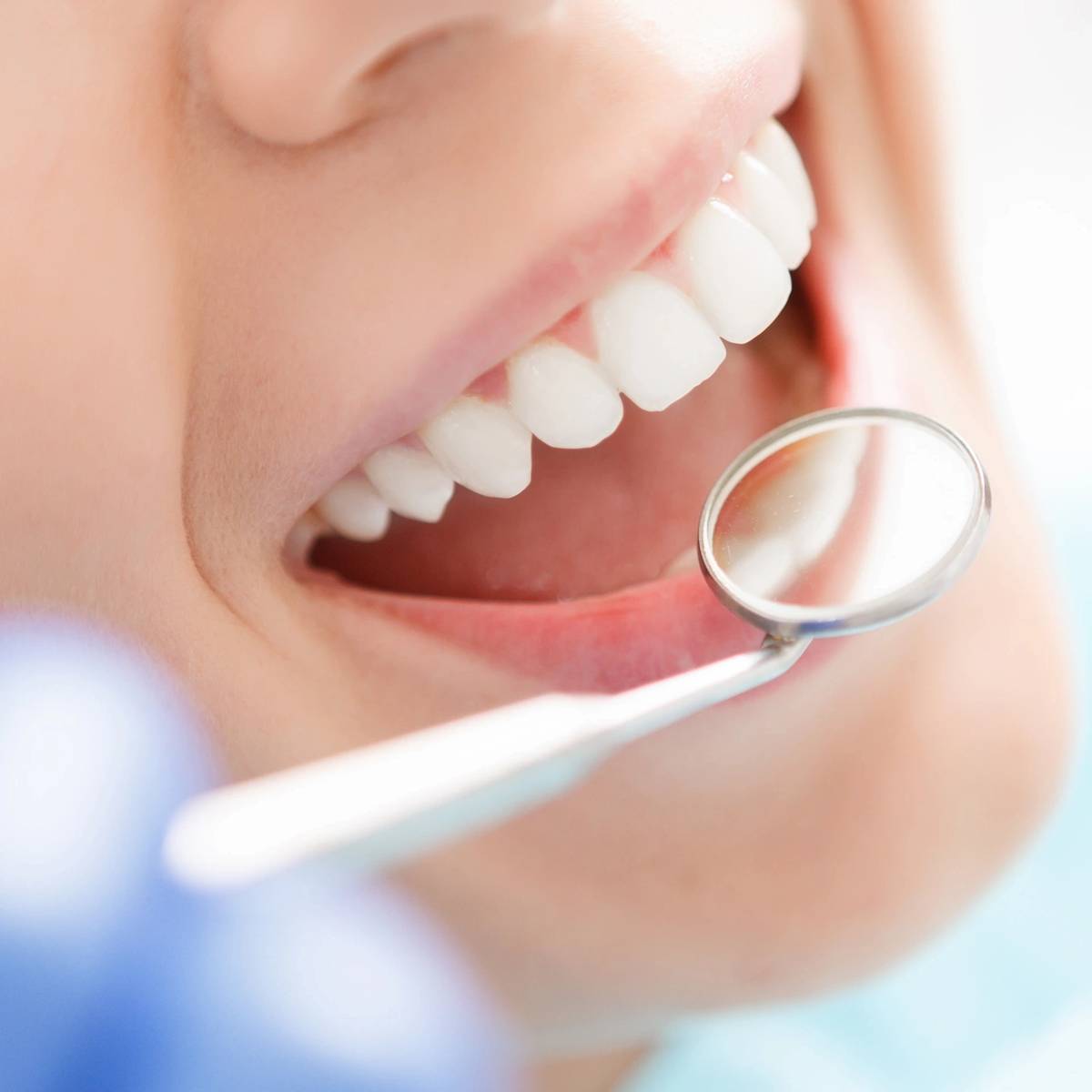 Close-up of a dental exam with mirror, highlighting teeth and gums.